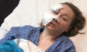 Турок-чоловік порізав обличчя молодій українці