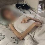 Заморил голодом отец! В Одессе врачи спасают 16-летнего парня, которого отец "лечил духовно"