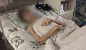 Заморил голодом отец! В Одессе врачи спасают 16-летнего парня, которого отец "лечил духовно"