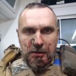 Олег Сенцов отримав поранення!