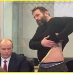 "В мене зламані два ребра": Дубинський в суді показав гематоми, та заявив по побиття його в СІЗО зі зламаними ребрами