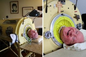 A man who spent his entire life in a medical capsule has died