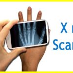 Scientists have created an X-ray chip for smartphones