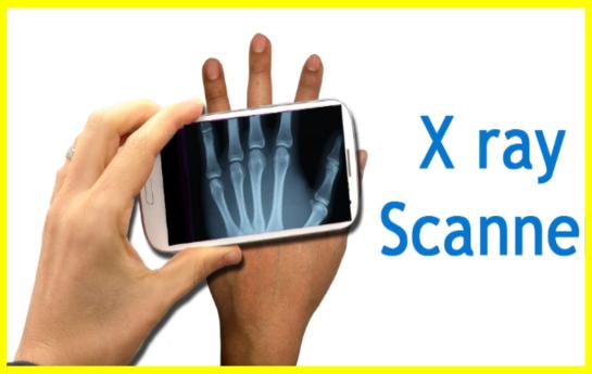 Scientists have created an X-ray chip for smartphones