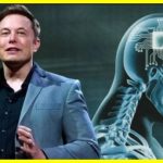 Brain-chip patient plays CS2