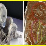 Scientists investigating the mummies of ‘alien’ from Peru made a shocking discovery. They found the remains of a fetus inside the mysterious mummy.