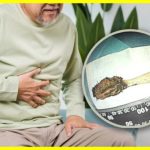 Китаєць 52 роки проходив із зубною щіткою в кишківнику