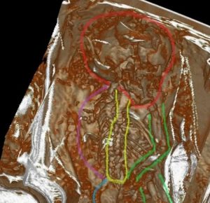 Scientists prove uniqueness of remains of mysterious mummies from Peru