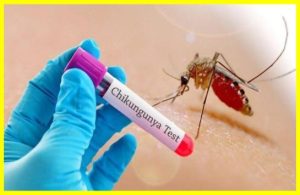 Chikungunya virus